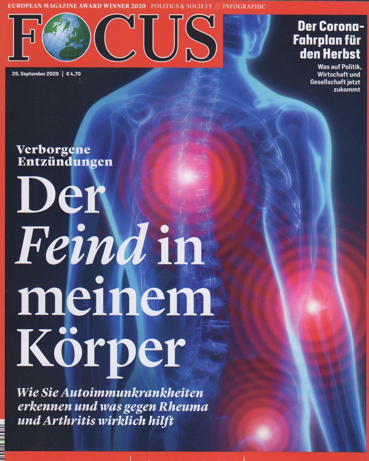 FOCUS Titelgeschichte "Der Feind in meinem Körper"